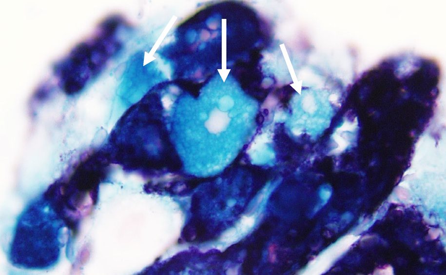 How Herpes Simplex Virus Exits Latency