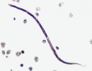 wuchereria microfilaria