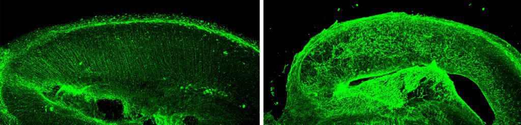 Zika fiber disruption